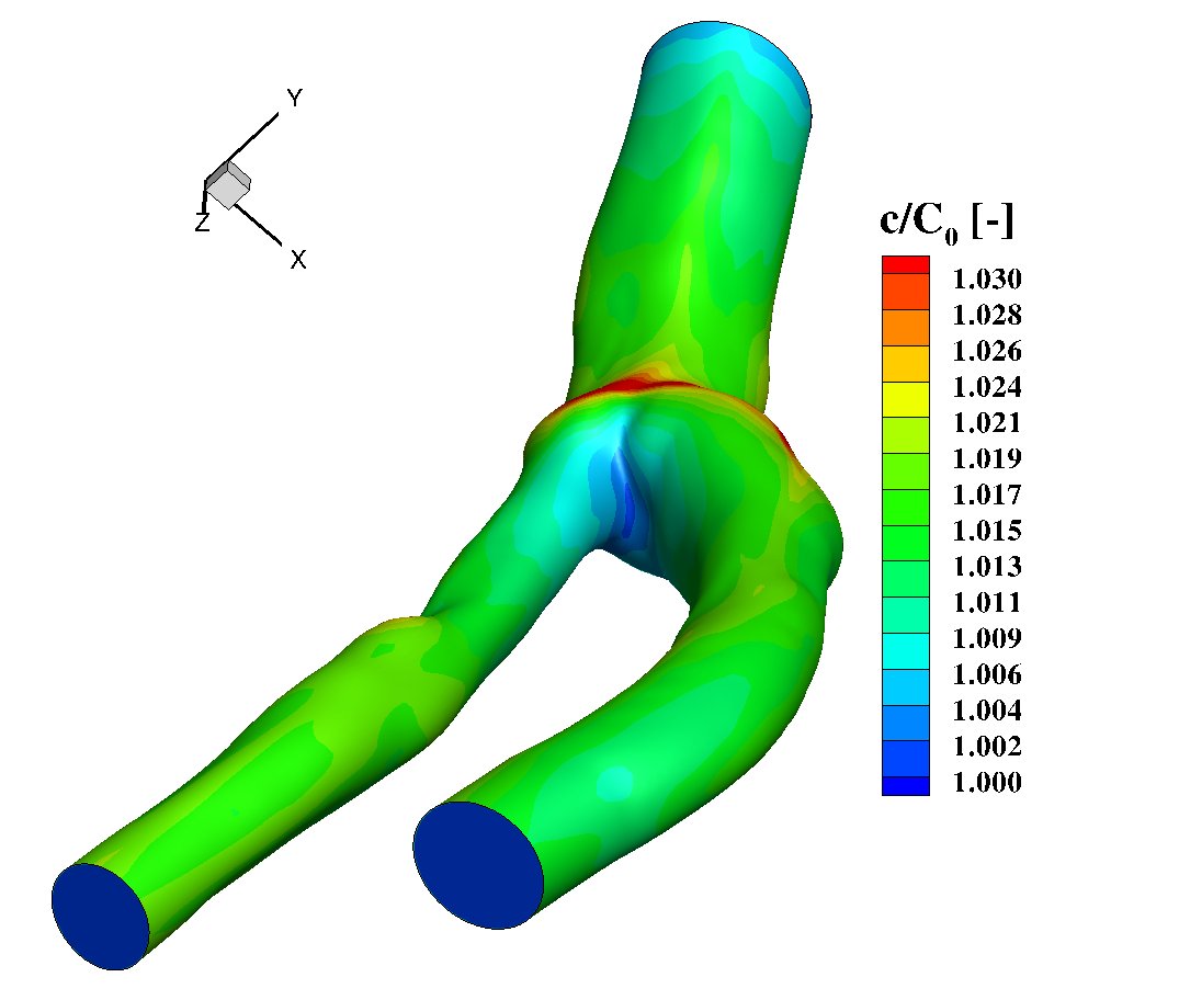Computer pinpoints atherosclerosis risk