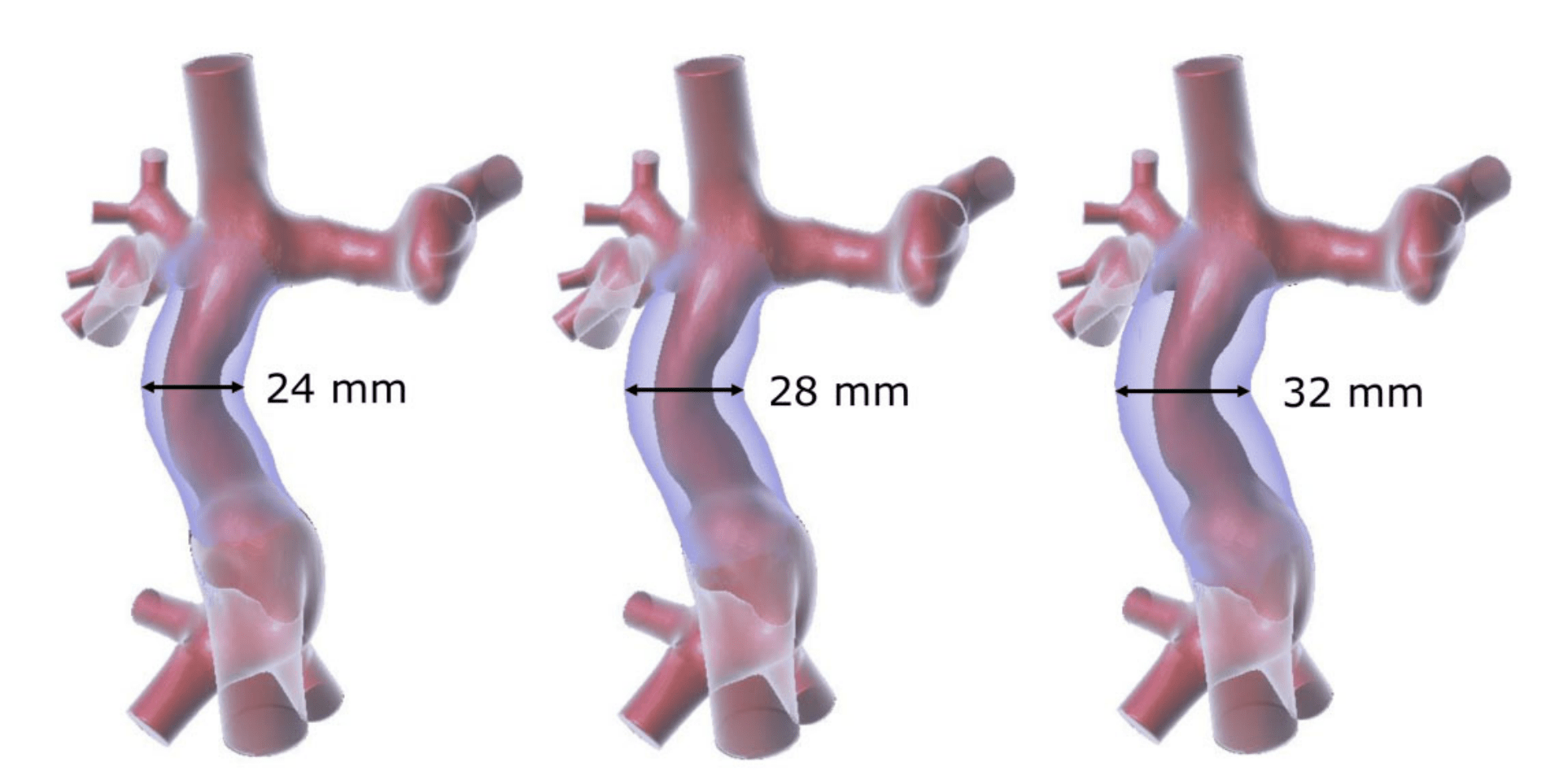 bloedvaten met omhulsel